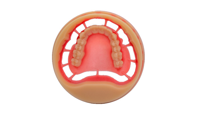 PMMA Resin Discs: The Diverse Radiance in Dental Applications