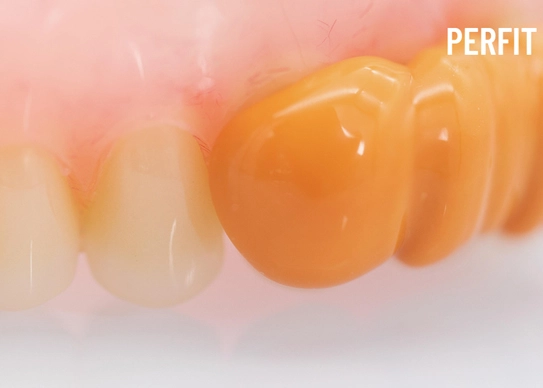 silicone impression material dental