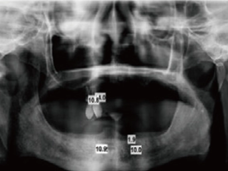 1. Ambil x-ray